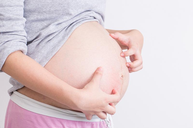 Prurito In Gravidanza Cause Principali Cure E Rimedi Naturali