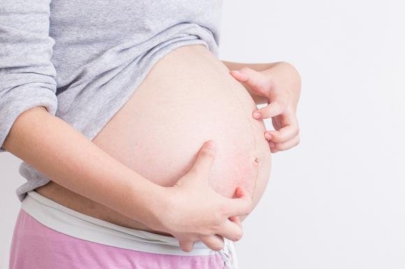 Prurito in gravidanza: le cause principali, cure e rimedi naturali
