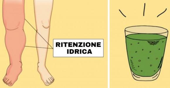 10 cibi e bevande che possono aiutarti a sbarazzarti della ritenzione idrica