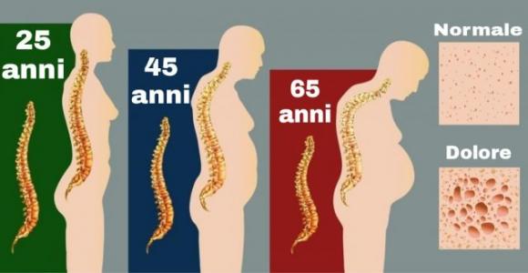 9 abitudini quotidiane che distruggono la tua spina dorsale