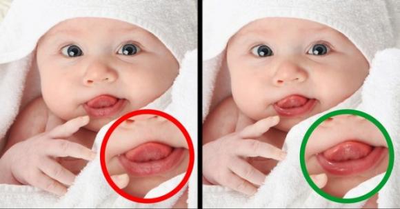 I modi principali per identificare e trattare l’infezione da rotavirus che ogni genitore dovrebbe conoscere
