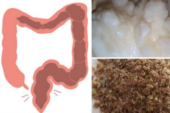 Con solo 2 ingredienti puoi rimuovere 13 kg di tossine depositate nel colon