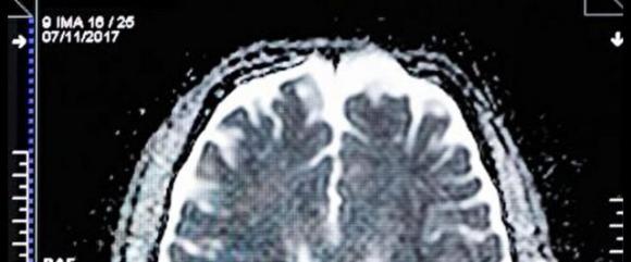 Secondo la scienza la dimenticanza è sinonimo di intelligenza