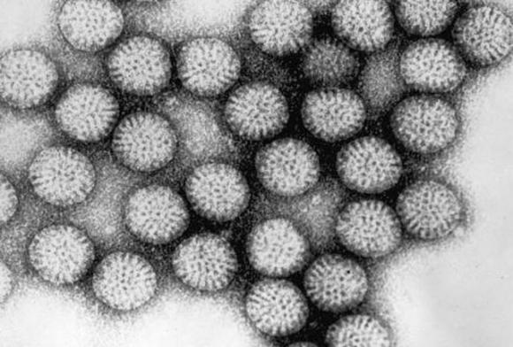 I modi principali per identificare e trattare l’infezione da rotavirus che ogni genitore dovrebbe conoscere