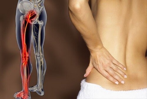 Il latte all’aglio è il miglior rimedio naturale contro la sciatica e il mal di schiena