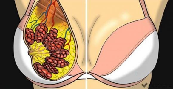 5 metodi semplici e naturali per rassodare il seno senza la chirurgia