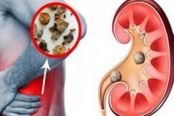 Gli incredibili benefici del bere acqua a stomaco vuoto subito dopo il risveglio