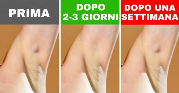 6 segnali d’allarme che riguardano le ascelle da non trascurare