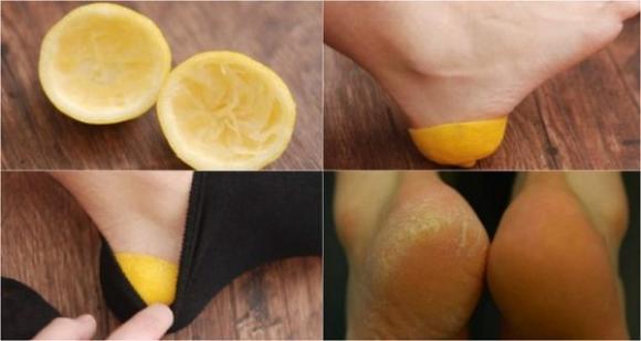Dopo aver letto questo articolo, non andrai più a letto senza un limone nei tuoi calzini