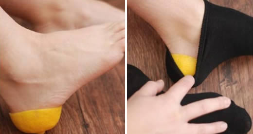 Dopo aver letto questo articolo, non andrai più a letto senza un limone nei tuoi calzini