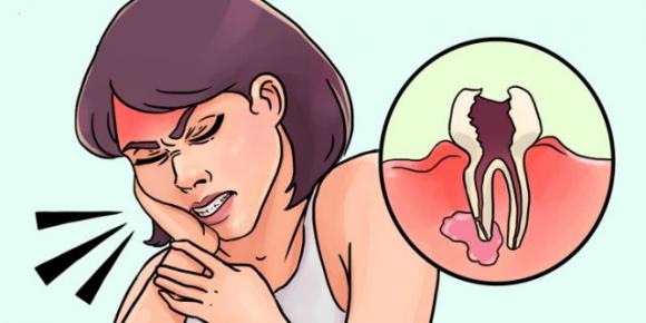 11 metodi efficaci per fermare il dolore al dente del giudizio