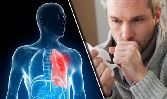 6 segni che il tuo corpo sta producendo muco eccessivo e come puoi sbarazzartene