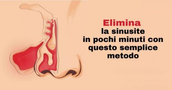 Ecco come puoi guarire dalla sinusite in pochi minuti con l’aceto di mele