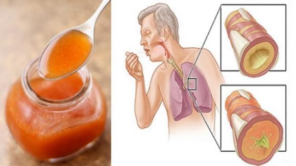 Sciroppo di carote, un rimedio naturale molto efficace per eliminare tosse, raffreddore e tanto altro!