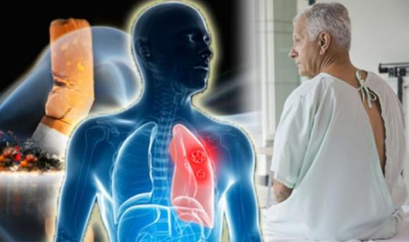 6 segni che il tuo corpo sta producendo muco eccessivo e come puoi sbarazzartene