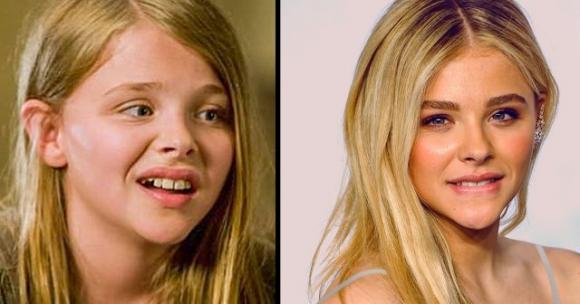 15 celebrità che fin dall’infanzia recitano in vari film e continuano ad essere bellissime