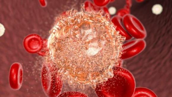 Scoperte cellule immunitarie TIL: nasce la speranza nella lotta contro il cancro al seno
