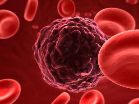 Scoperte cellule immunitarie TIL: nasce la speranza nella lotta contro il cancro al seno