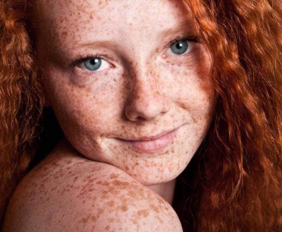 Le persone con i capelli rossi hanno una salute migliore rispetto agli altri: lo rivela uno studio
