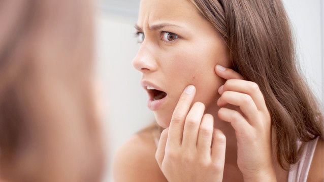 Come contrastare l’insorgenza dei brufoli