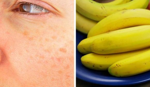 6 ormoni che fanno invecchiare le donne precocemente
