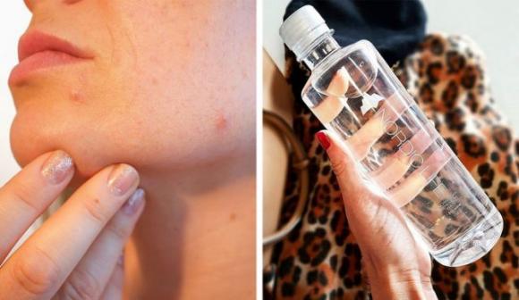 6 ormoni che fanno invecchiare le donne precocemente