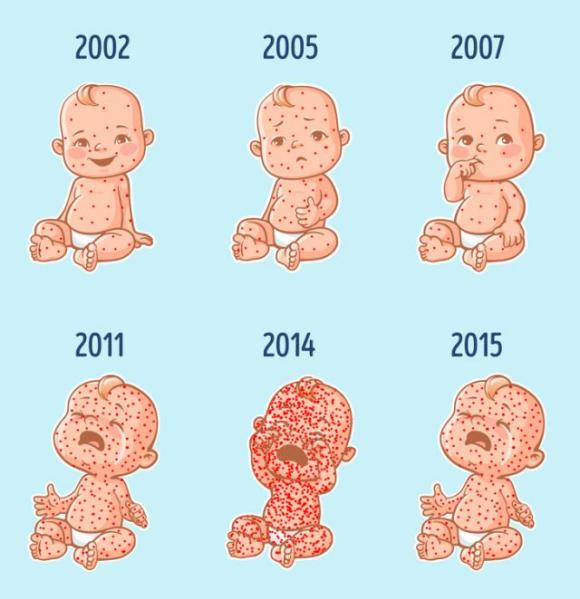 Vaccini, alcune informazioni utili che tutti i genitori dovrebbero conoscere