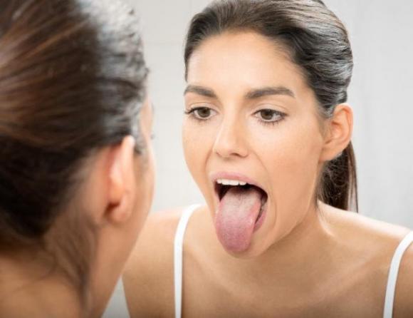 Xerostomia, 7 facili consigli per curare i sintomi della bocca secca