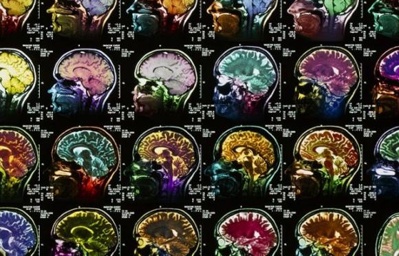 Infiammazione cronica e depressione: esiste un legame? Così ci roviniamo la vita