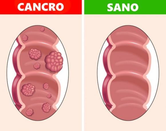Ecco cosa succede al tuo corpo se mangi tre datteri al giorno per una settimana