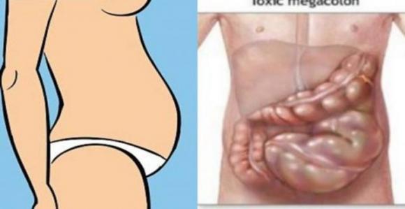 Pancia gonfia addio: le cause più comuni e 7 rimedi naturali per ritrovare il benessere