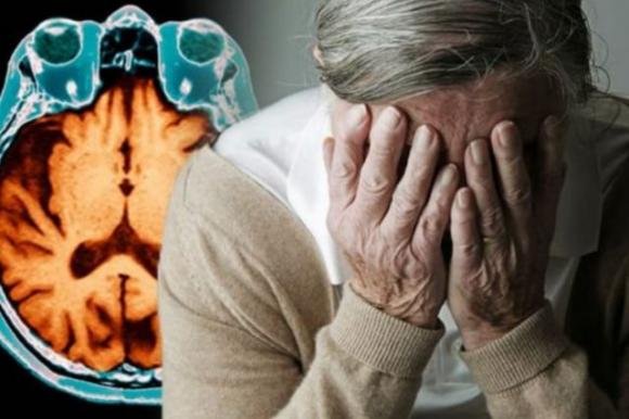 Alzheimer, il sintomo della malattia fino a 20 anni prima
