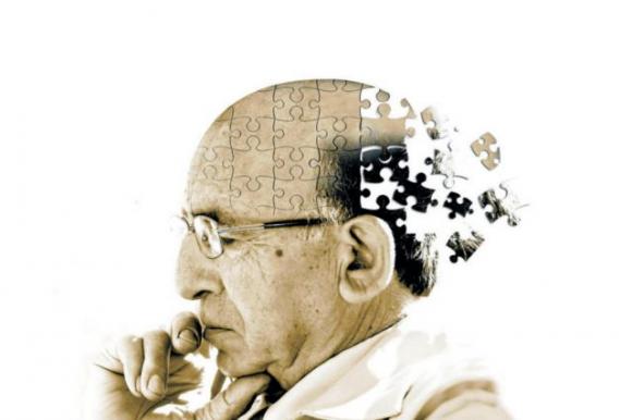 L’olio extra-vergine di oliva protegge il cervello dall’Alzheimer