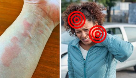 Dolori articolari: 5 cose importanti da sapere e i sintomi iniziali a cui prestare attenzione