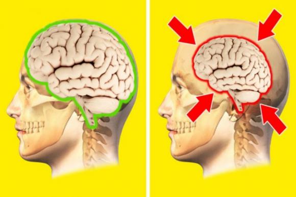Lo stress e la depressione rimpiccioliscono il cervello, lo rivela uno studio