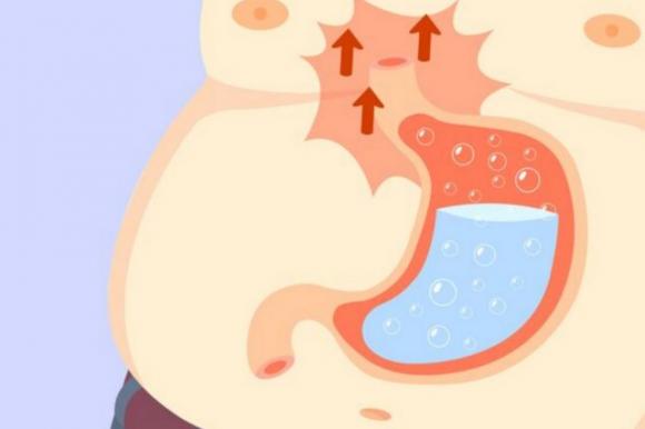 I sintomi della gastrite, come riconoscerla e curarla al più presto