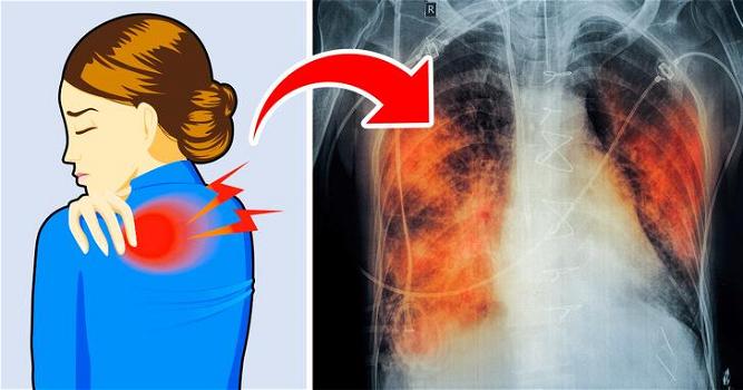 5 segnali che possono indicare un problema ai polmoni: non sottovalutarli