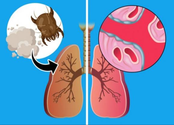 5 segnali che possono indicare un problema ai polmoni: non sottovalutarli