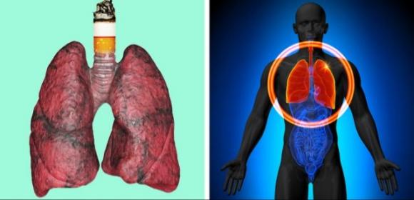 5 segnali che possono indicare un problema ai polmoni: non sottovalutarli