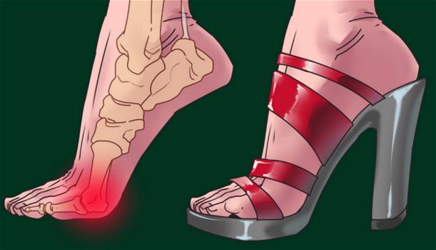 I tacchi alti non solo rovinano i tuoi piedi ma possono provocare gravi conseguenze anche in altre 3 parti del corpo