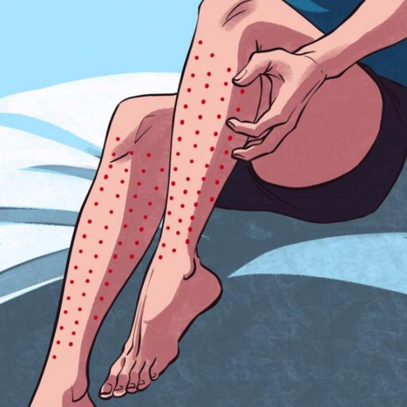 Sindrome delle gambe senza riposo: cos’è, come riconoscerla e quando farsi visitare da un medico