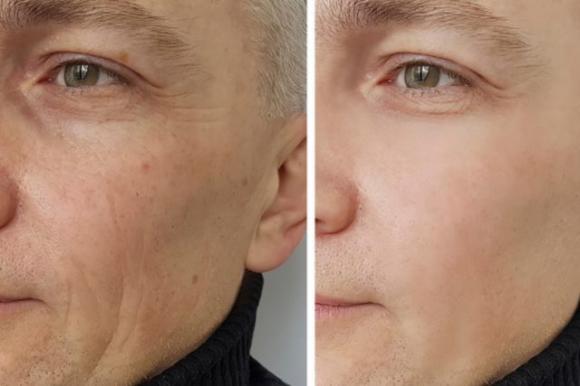 Olio di ricino, un vero elisir di bellezza. Ecco tutti i suoi benefici per il tuo corpo
