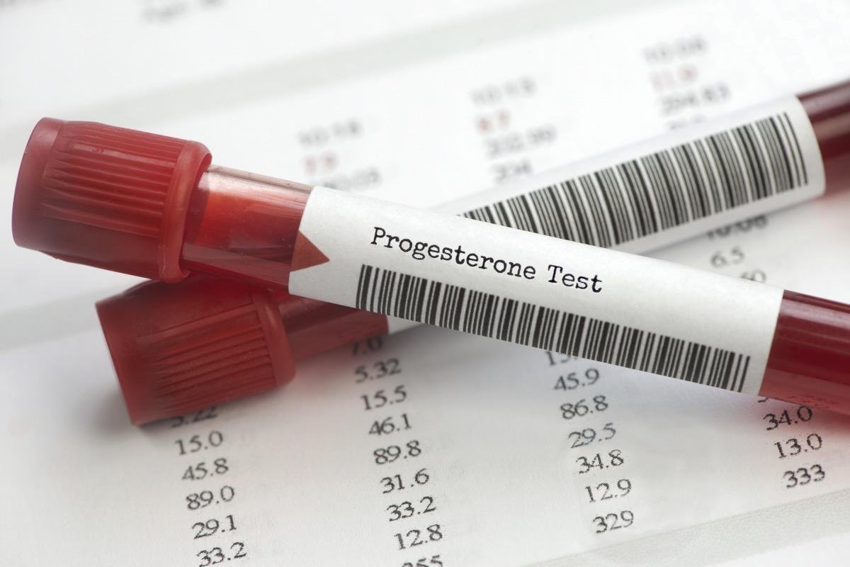 Attraverso le analisi del sangue è possibile risalire al valore del progesterone