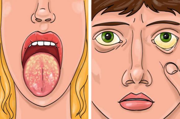 8 malattie difficili da diagnosticare: i sintomi spesso vengono associati a condizioni di salute meno gravi