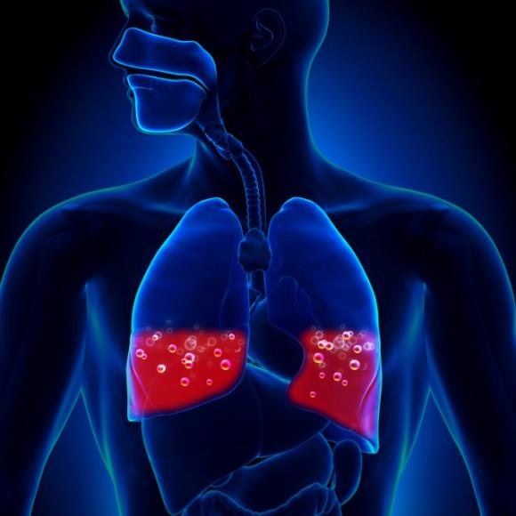 8 malattie difficili da diagnosticare: i sintomi spesso vengono associati a condizioni di salute meno gravi