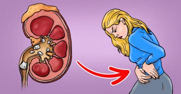 8 malattie difficili da diagnosticare: i sintomi spesso vengono associati a condizioni di salute meno gravi