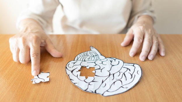 Alzheimer: prevenire e riconoscere i primi sintomi per curare