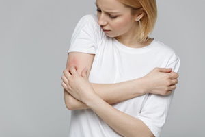 Mollusco contagioso: cause, terapia e rimedi naturali
