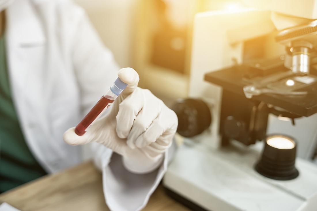 Formula leucocitaria: cos’è, valori normali e formula invertita