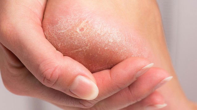 Scrub e maschera nutriente: due fantastici rimedi naturali per una perfetta pedicure